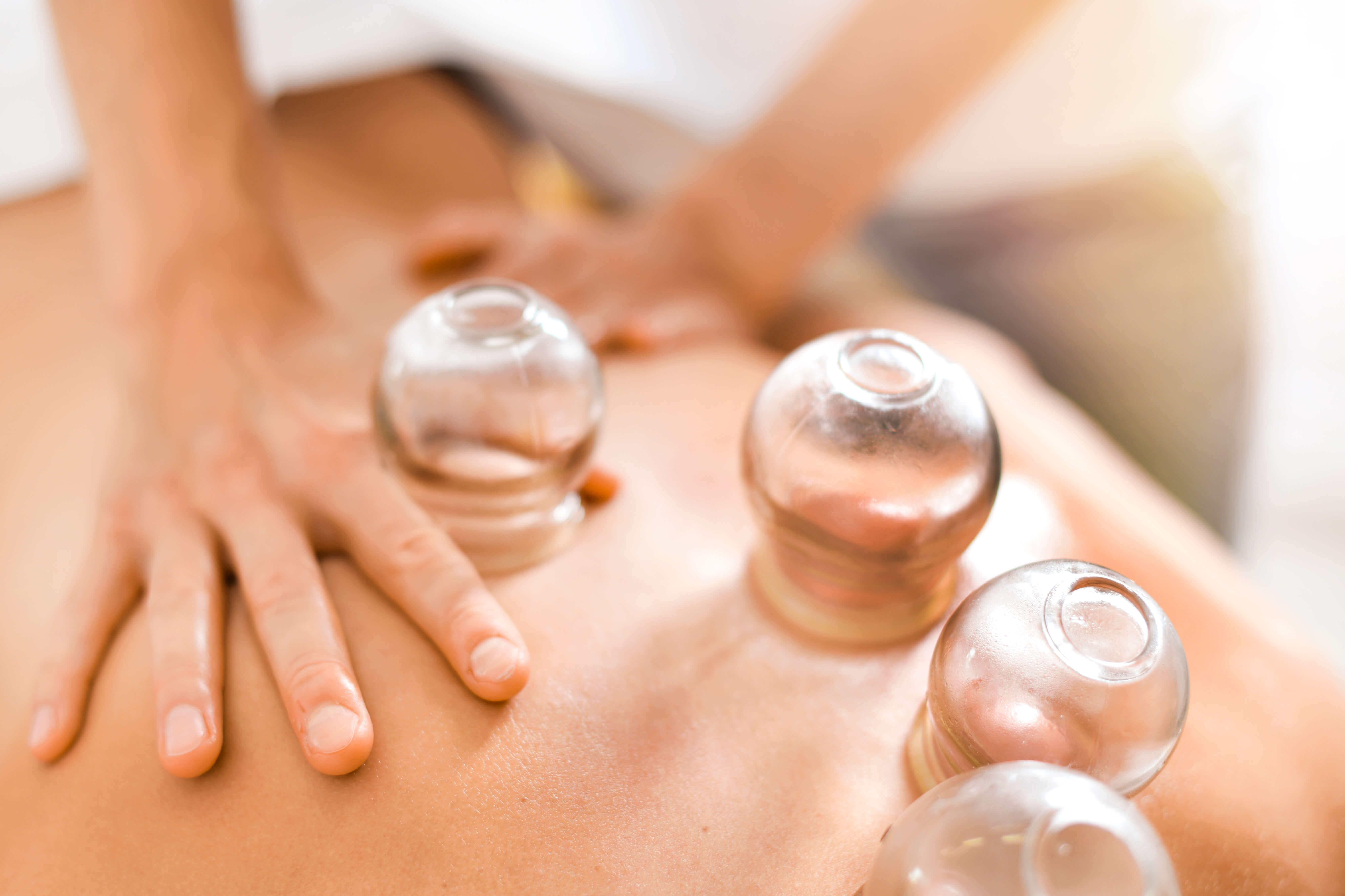 RMT Cupping Therapy  |  Indian Head Massage | Hot Stones